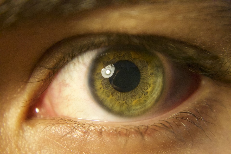 macular degeneration